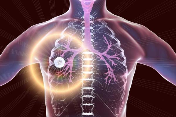 World Tuberculosis Day