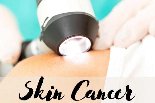Skin Cancer Awareness Month